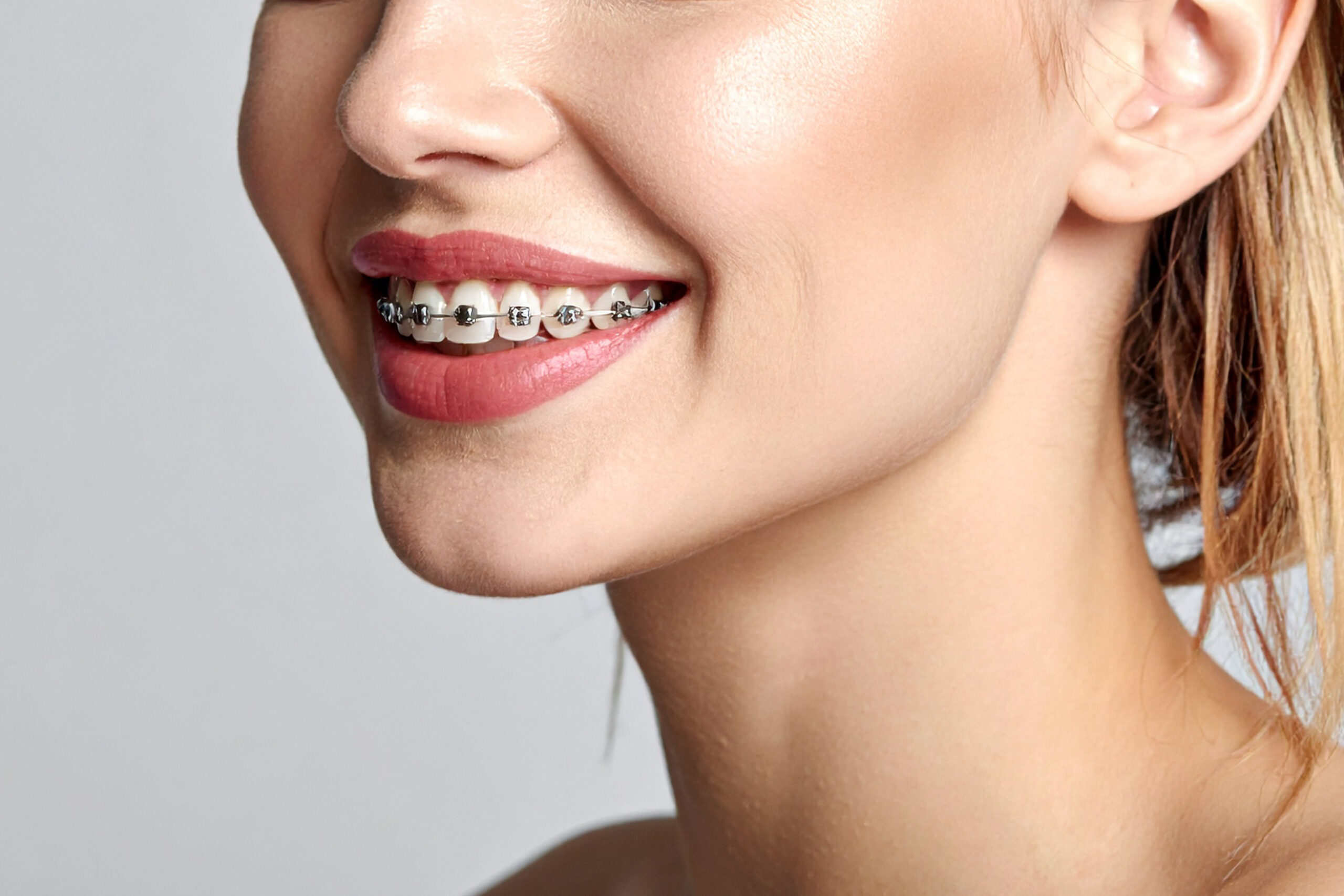 Orthodontic treatment at ETON Dental in Canoga Park, Los Angeles, CA – braces and clear aligners to straighten teeth, improve smiles, and restore bite.