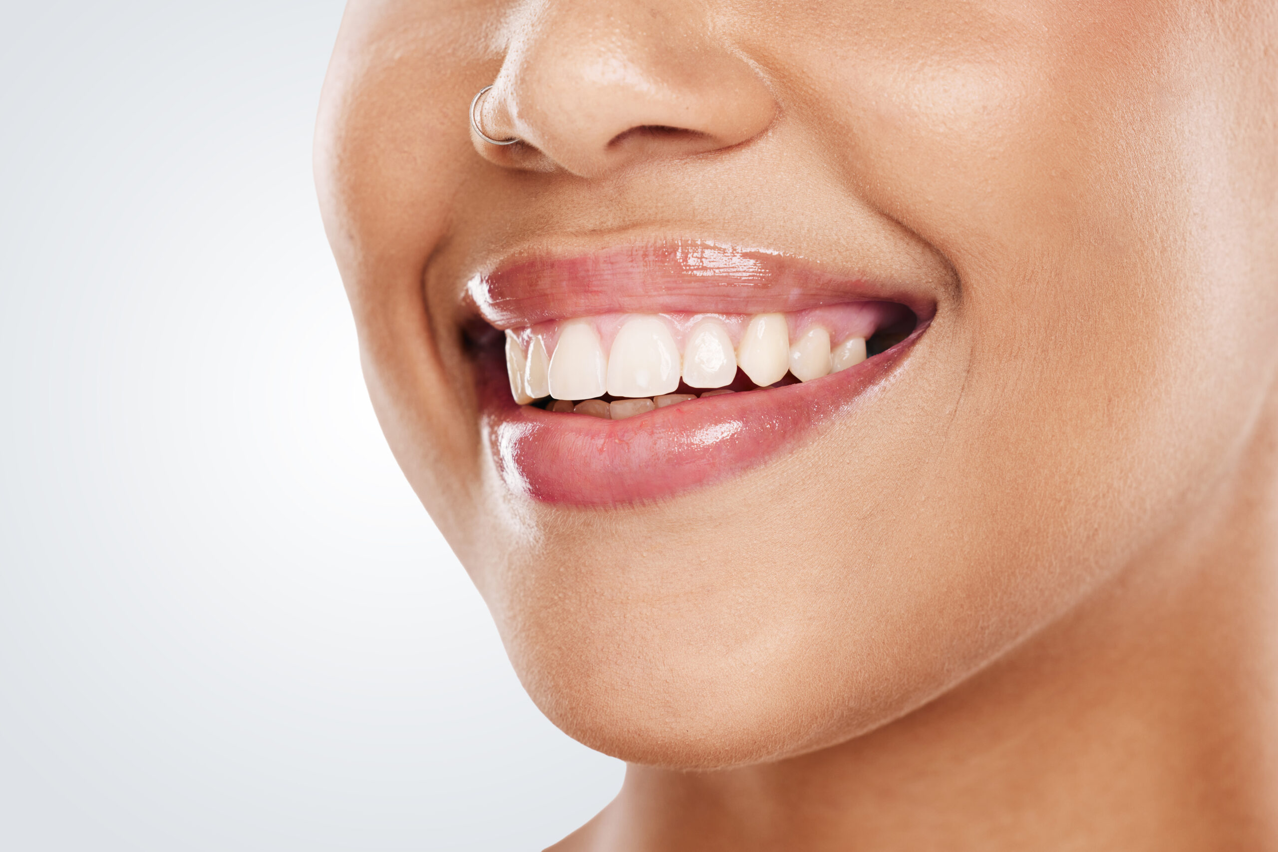 Professional teeth whitening at ETON Dental in Canoga Park, Los Angeles, CA – safe Zoom Whitening treatment for a brighter, whiter, natural-looking smile.